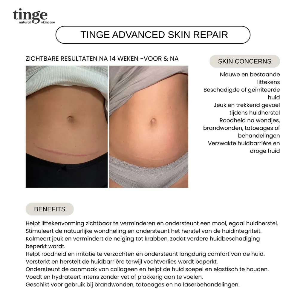 Tinge Advanced Skin Repair (anti-litteken) 20ml
