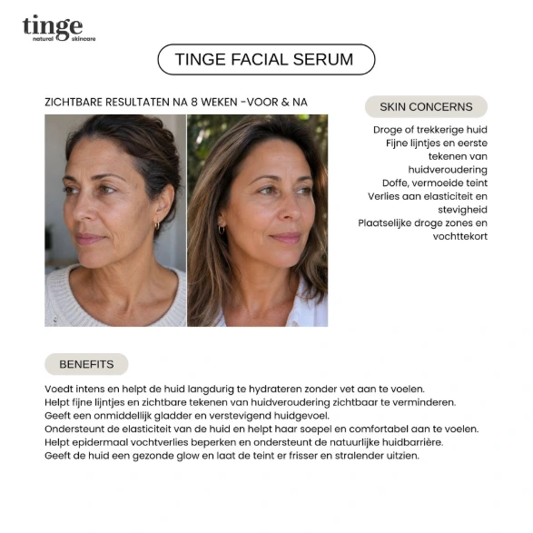 Tinge Gezichtsserum 30ml