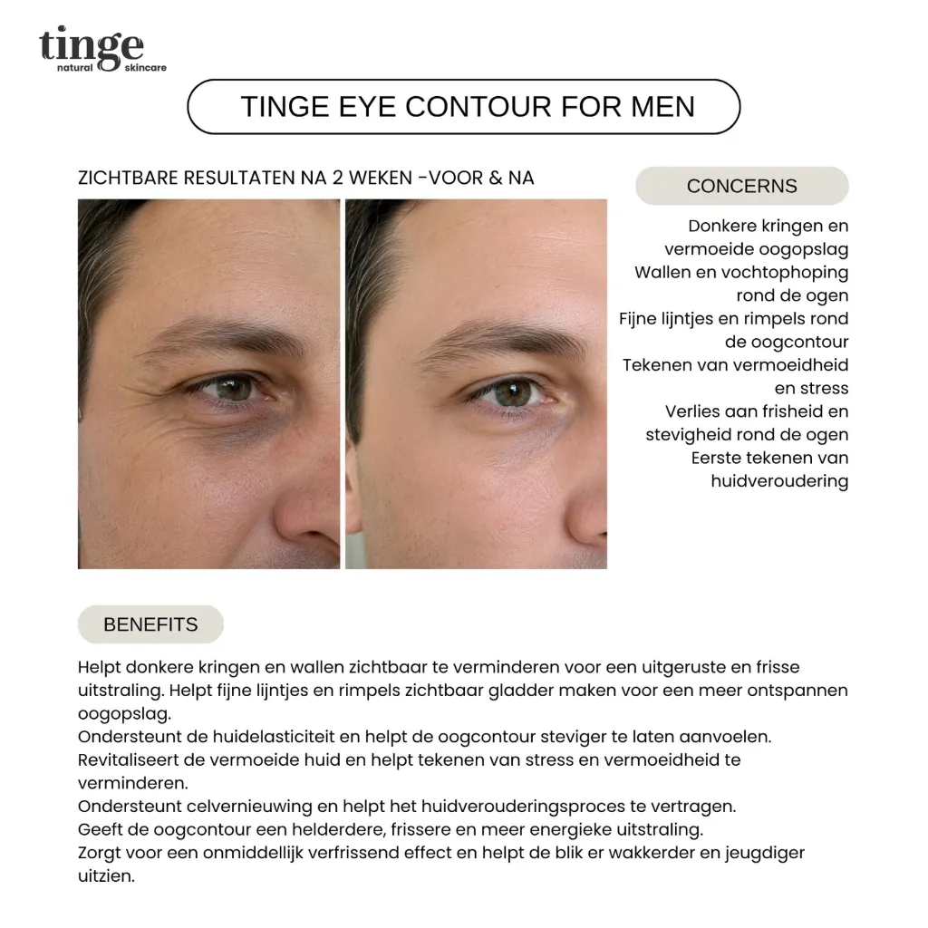 Tinge eye contour for men 10ml