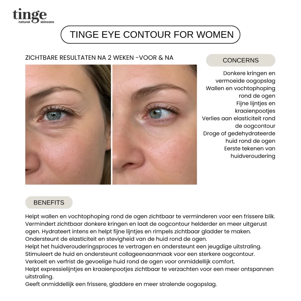 Tinge eye contour for women 10ml
