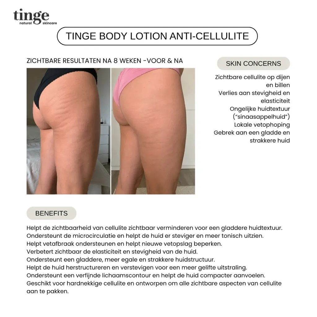 Tinge Anti-cellulite body crème 200ml