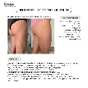 Tinge Anti-cellulite body crème 200ml